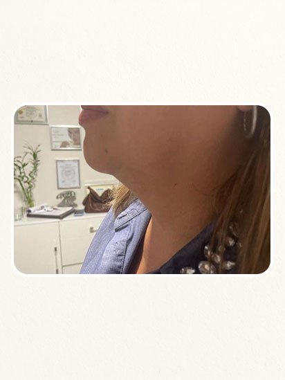 After skincare treatment at CaraBella Skin