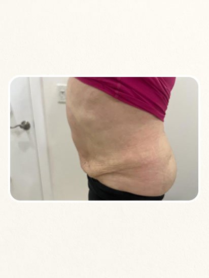After skincare treatment at CaraBella Skin