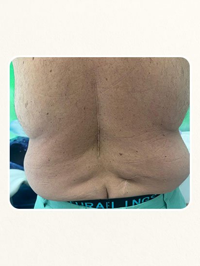 After skincare treatment at CaraBella Skin