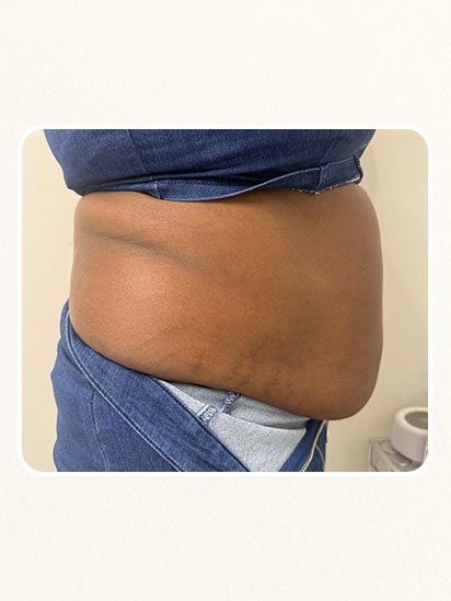 After skincare treatment at CaraBella Skin